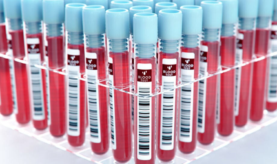 A Short History of Doping in Athletics (+infographic)